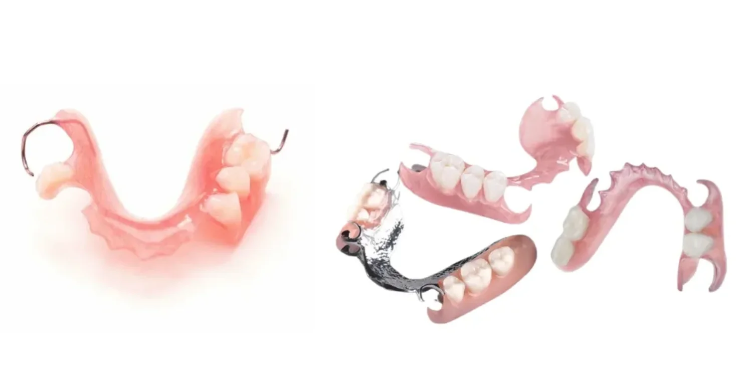 flexible partial dentures vs metal 2